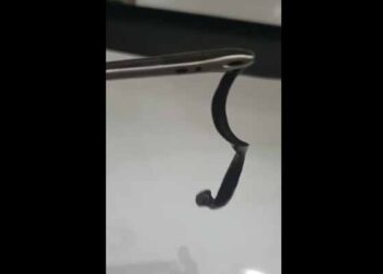 Phú Thọ: Gắp con vắt sống gần một tháng trong mũi trẻ 5 tuổi