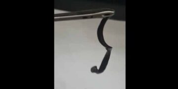 Phú Thọ: Gắp con vắt sống gần một tháng trong mũi trẻ 5 tuổi